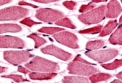 Immunohistochemistry-Paraffin: Glycogen phosphorylase, muscle form Antibody [NBP3-14337] - Immunohistochemistry of formalin-fixed, paraffin-embedded human skeletal muscle after heat-induced antigen retrieval.